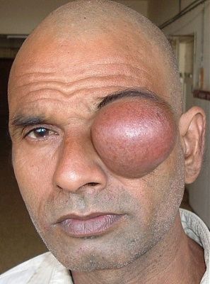 eyeball.jpg