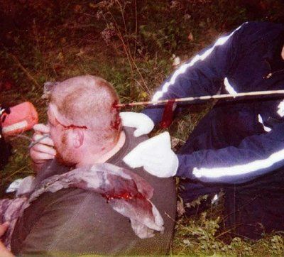 bowhunt_accident.jpg