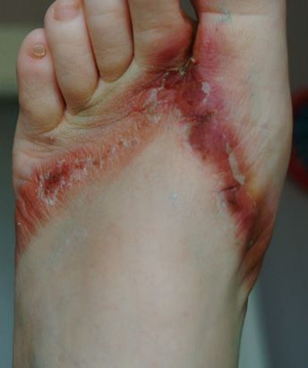 foot1.jpg