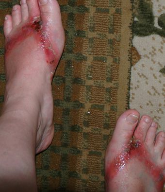 foot2.jpg