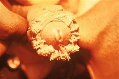 crunchy-penis-84ebac25-b.jpg