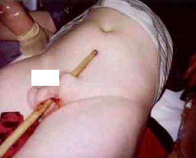 snooker-fig2.jpg