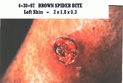 brspider1.gif
