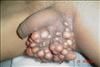 ascrotum1.jpg