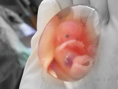 10-wks-lmp.jpg