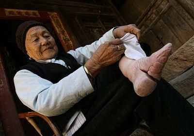 deformed-feet-elderly-asian-woman-weari1.jpg