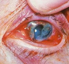 eye.jpg