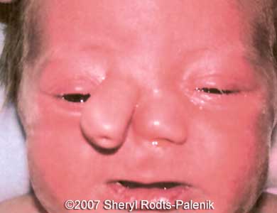 nose1.jpg
