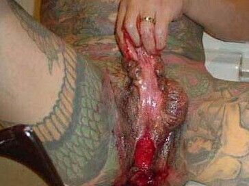 ripped_penis_1.jpg
