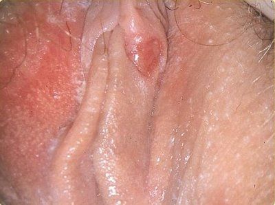 std4.jpg