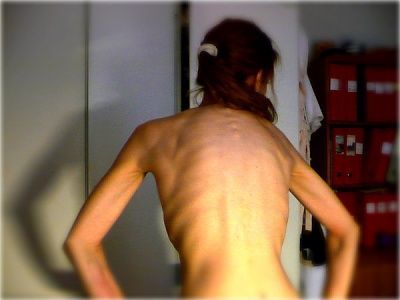 anorexic_reality.jpg