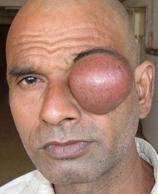 eye3.jpg