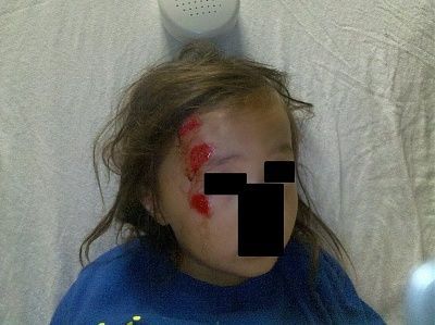 injury1.jpg