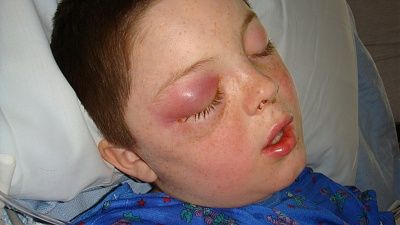 nicks-illness-12-2008-070.jpg