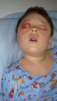 nicks-illness-12-2008-080.jpg
