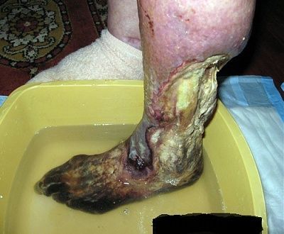 041910-late-night-foot-soak.jpg