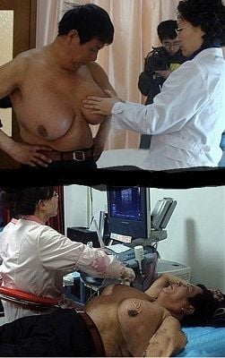 032810-worlds-biggest-manboobs.jpg
