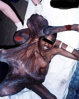 042610-human-octopus.jpg
