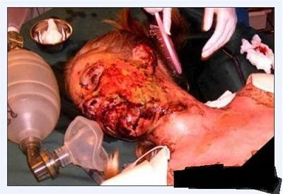 022710-allergic-reaction.jpg