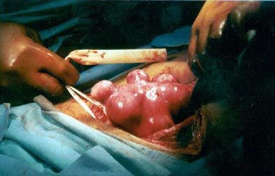 com_surgeryphotos_32a_LG.jpg