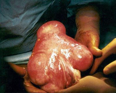 com_surgeryphotos_41a_LG.jpg
