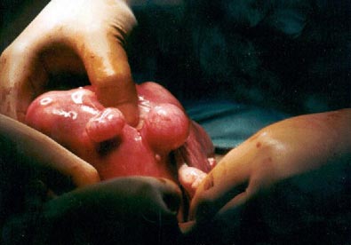 com_surgeryphotos_43a_LG.jpg