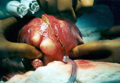 com_surgeryphotos_51a_LG.jpg