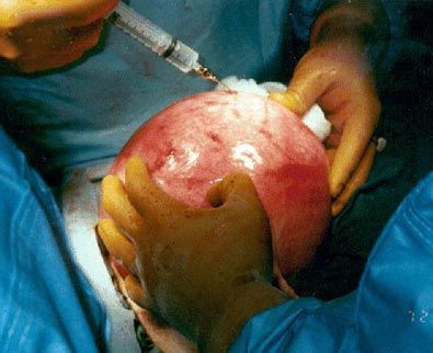 com_surgeryphotos_54a_LG.jpg