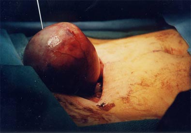 com_surgeryphotos_fas_B1_LG.jpg