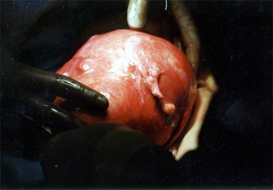 com_surgeryphotos_fas_C1_LG.jpg