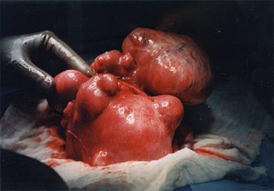 com_surgeryphotos_fas_F1_LG.jpg