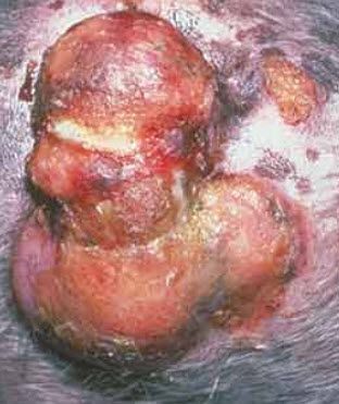 tumor-1.jpg