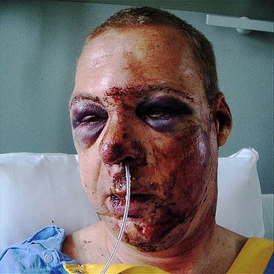 facial-1.jpg