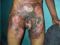 guyana-torture.jpg