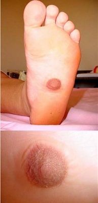 foot-fetish-anybody.jpg