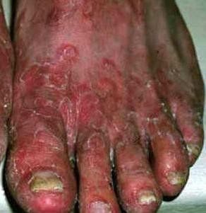 feet-00d-4.jpg
