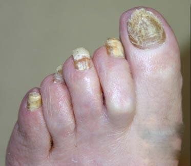 feet-00d-1.jpg