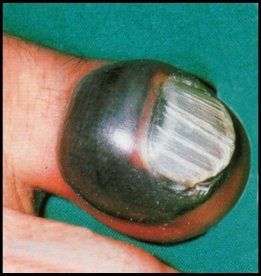 toe-jam.jpg