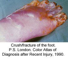 festered_limbs_feet_fingers051.jpg