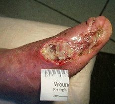 mmmm-diabetes-7.jpg