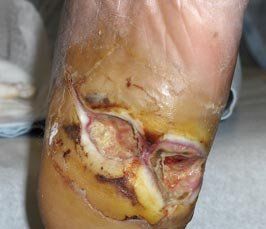 mmmm-diabetes-5.jpg