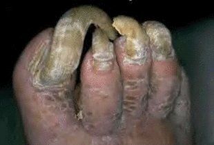 way-beyond-pedicure-help-8.jpg