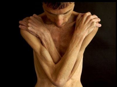 maleanorexia2.jpg