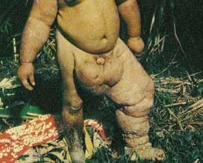 anomalies-and-diseases-on-people-15.jpg