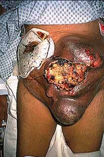 anomalies-and-diseases-on-people-5.jpg
