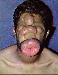 anomalies-and-diseases-on-people-4.jpg
