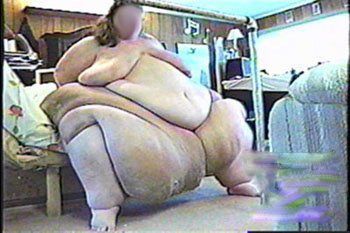 anomalies-and-diseases-on-people-2.jpg