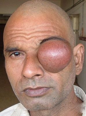 eye-can-t-believe-1.jpg