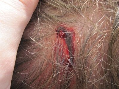 bumps-bump.jpg