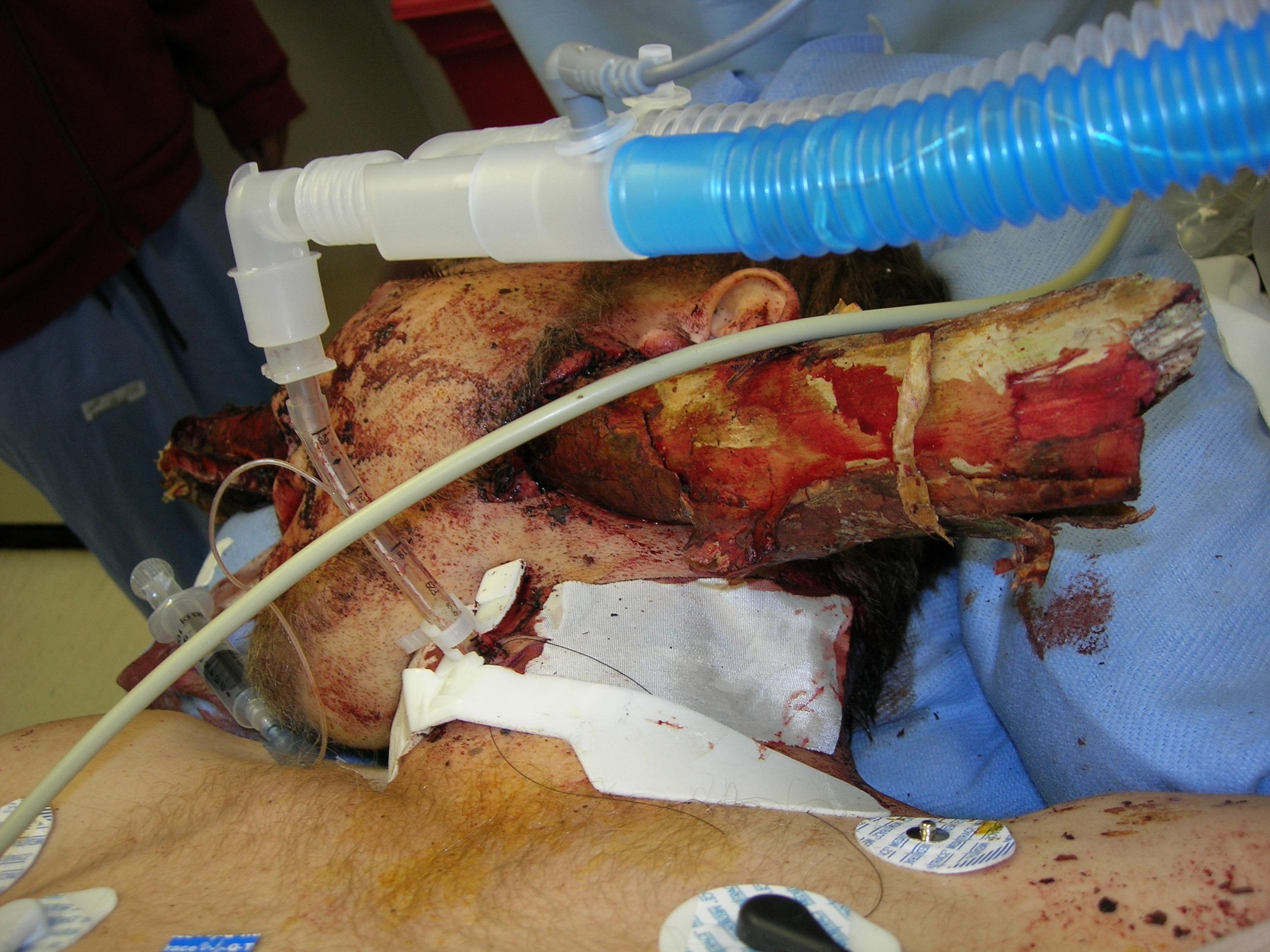 Head impalement 1.jpg